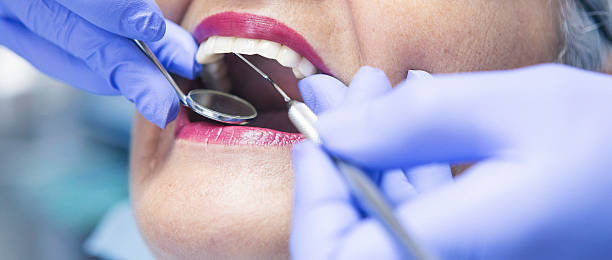 Best Emergency Tooth Extraction in St Clair, MO